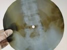 DAVID BOWIE BEWLAY BROTHERS X-Ray USSR Record Roentgen Bones Ribs Music Vinyl