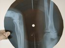 BLACK SABBATH BLACK SABBATH X-Ray USSR Record Roentgen Bones Ribs Music Vinyl