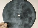 BEATLES CANT BUY ME LOVE X-Ray USSR Record Roentgen Bones Ribs Music Vinyl