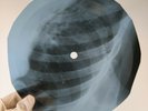 GENE VINCENT BE POP A LULA X-Ray USSR Record Roentgen Bones Ribs Music Vinyl