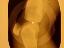 Beatles - Polythene Pam X-RAY OF USSR X-RAY BONES RECORD