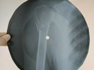 LED ZEPPELIN LEMON SONG X-Ray USSR Record Roentgen Bones Ribs Music Vinyl