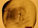 Beatles - Night Before  X-RAY OF USSR X-RAY BONES RECORD