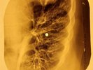 Beatles - Can't Buy Me Love X-RAY OF THE USSR X-RAY BONES RECORDING