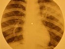 Beatles - Girl X-RAY OF THE USSR X-RAY BONES RECORD