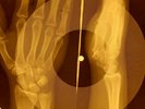 Elvis Presley - Like A Baby X-RAY OF THE USSR X-RAY BONES RECORDING