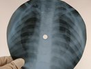 FRANK SINATRA PS I LOVE YOU X-Ray USSR Record Roentgen Bones Ribs Music Vinyl