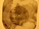 Rolling Stones - Fortune Teller X-RAY OF THE USSR X-RAY BONES RECORDING
