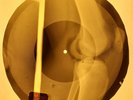 Smokie - Jet Lagged X-RAY OF USSR X-RAY BONES RECORDING