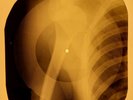 Beatles - March of the Meanies X-RAY OF THE USSR X-RAY BONES RECORD