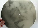 X-RAY 78rpm ROSEMARY CLOONEY - Mambo Italiano USSR ROENTGEN Pelvis Stomach 1950s