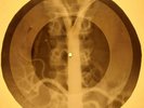 Bill Haley & His Comets - Rock Around The Clock X-RAY OF USSR X-RAY BONE RECORD