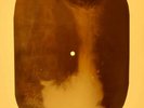 Beatles - Eleanor Rigby X-RAY OF THE USSR X-RAY BONES RECORDING