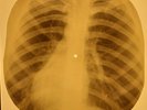 Doors - Unknown Soldier X-RAY OF USSR X-RAY BONES RECORD