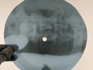 DAVID BOWIE FILL YOUR HEART X-Ray USSR Record Roentgen Ribs Bones Music Vinyl