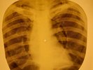 Beatles - She Said She Said X-RAY OF USSR X-RAY BONES RECORD