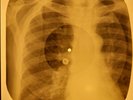 Rolling Stones - Bitch X-RAY OF USSR X-RAY BONE RECORDING