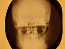 Doors - Peace Frog X-RAY OF THE USSR X-RAY BONES RECORD