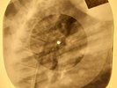 Beatles - Taxman X-RAY OF THE USSR X-RAY BONES RECORDING