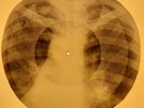 Monkees - Daydream Believer X-RAY OF THE USSR X-RAY BONES RECORD