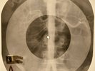 Rolling Stones - Country Honk X-RAY OF USSR X-RAY BONES RECORD