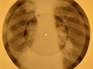 Jackie Wilson - Reet Petite X-RAY OF USSR X-RAY BONES RECORDING
