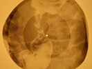 Betty Everett - It's In His Kiss X-RAY OF USSR X-RAY BONES RECORD