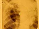 Beatles - Don't Bother Me X-RAY OF USSR THE X-RAY BONES RECORD