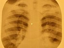 Monkees - I'm a Believer  X-RAY OF THE USSR X-RAY BONES RECORDING