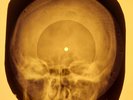 Beatles - Twist And Shout  X-RAY OF THE USSR X-RAY BONES RECORDS