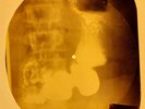 Louis Armstrong - La Vie En Rose X-RAY OF USSR X-RAY BONES RECORDS