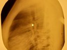 Beatles - When I Get Home X-RAY OF USSR X-RAY BONES RECORDING