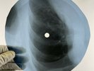 DOORS WHO SCARED YOU X-Ray USSR Record Roentgen Ribs Bones Music Vinyl