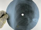 BEATLES I SHOUD KNOW BETTER X-Ray USSR Record Roentgen Ribs Bones Music Vinyl