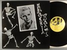Ronnie Dawson  Rocking Bones  Rockabilly; Rock 'n Roll  1988 Comp UK Press
