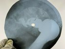 ELTON JOHN VAL HALA X-Ray USSR Record Roentgen Ribs Bones Music Vinyl