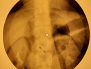Chubby Checker - Let's Twist Again X-RAY OF USSR X-RAY BONES RECORDING