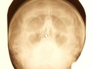 Rolling Stones - You Can Make It If You Try X-RAY OF USSR X-RAY BONES RECORDS