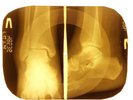 Elvis Presley - It's Carnival Time  X-RAY OF THE USSR X-RAY BONES RECORDING