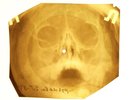 Beatles - Wild Honey Pie X-RAY OF THE USSR X-RAY BONES RECORD