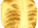 Bob Marley - Waiting In Vain X-RAY OF USSR X-RAY BONES RECORDS