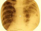 Johnny Cash - Thanks A Lot  X-RAY OF USSR X-RAY BONE RECORD