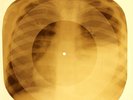 Beatles - Sea Of Holes X-RAY OF THE USSR X-RAY BONES RECORDING