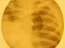 Who - I Can See For Miles X-RAY OF THE USSR X-RAY BONES RECORDING
