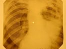 Who - Seeker X-RAY OF THE USSR X-RAY BONES RECORDING
