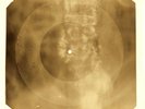 Chuck Berry - Misery X-RAY OF USSR X-RAY BONES RECORDING
