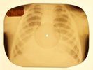 Elvis Presley - A Mess Of Blues X-RAY OF USSR X-RAY BONES RECORD