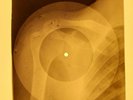 Rolling Stones - Singer Not The Song X-RAY OF THE USSR X-RAY BONES RECORDS