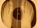 Doors - Changeling X-RAY OF THE USSR X-RAY BONES RECORDING