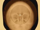 Elvis Presley - In The Ghetto X-RAY OF THE USSR X-RAY BONES RECORDING SKULL
